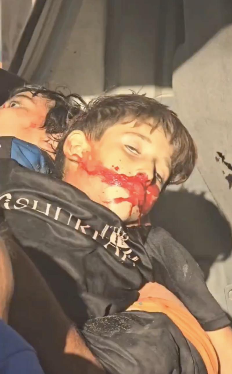 قصف أطفال يلعبون في مخيم الشاطئ